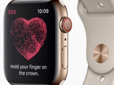 Su Apple Watch è in arrivo l’elettrocardiogramma
