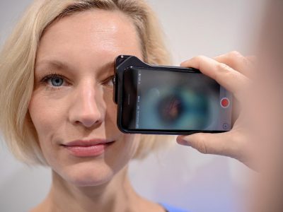 Che cos’è il glaucoma