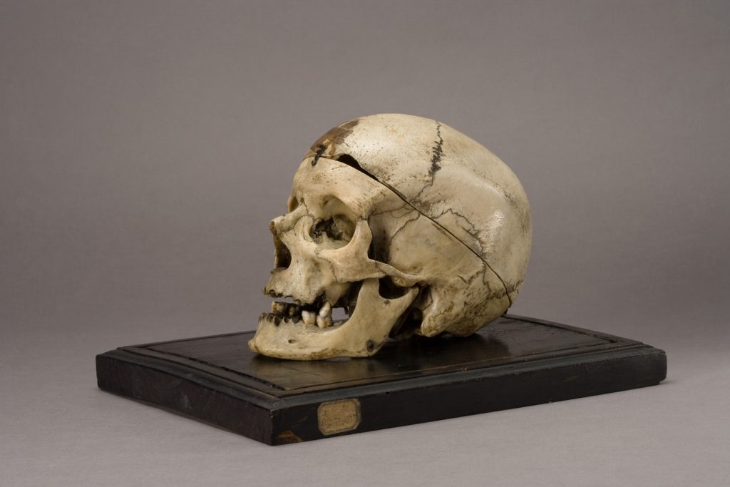 Cranio del brigante Giuseppe Villella - Museo Lombroso, Torino