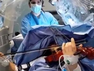 Ragazza operata al cervello mentre suona il violino