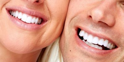Da studi medici: sbiancanti per denti a “...