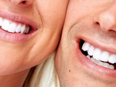 Da studi medici: sbiancanti per denti a “rischio sorriso”