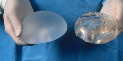 Francia: ritirate protesi al seno a rischio tumore