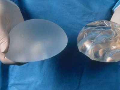 Francia: ritirate protesi al seno a rischio tumore