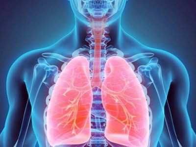 Scoperte nuove cellule immunitarie nei tumori al polmone