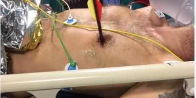 Cuore trappassato da un freccia di 30 cm, il pa...