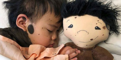 Disabilità infantile, arrivano dagli Usa le ...