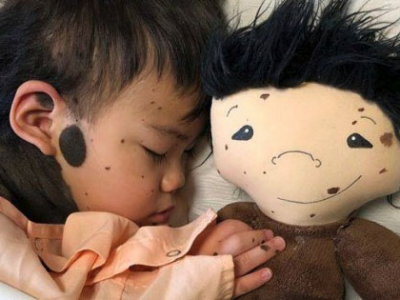 Disabilità infantile, arrivano dagli Usa le “bambole come me”