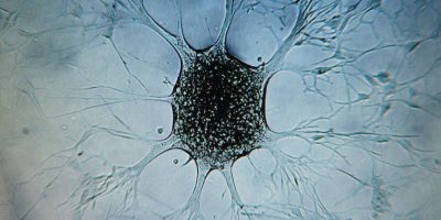 Uno studio italiano scopre la proteina che nutr...