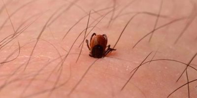Aumento infezioni da zecche in Italia. Nuove te...