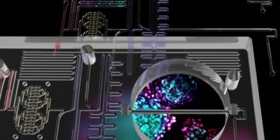 Arriva da Harvard il pancreas su chip ottenuto ...