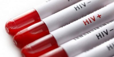 Nasconde Hiv e contagia almeno 4 donne: una muore