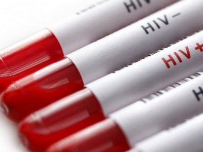 Nasconde Hiv e contagia almeno 4 donne: una muore