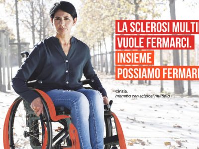 Sclerosi multipla: effetti benefici e dannosi della microglia