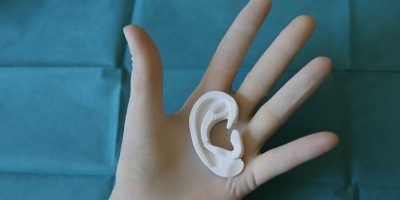 Primo caso italiano di orecchio in 3D, nuova fr...