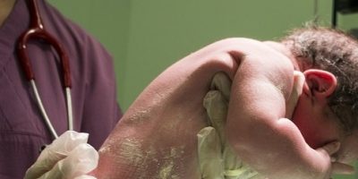 Nasce senza occhi e naso, ma il ginecologo non ...