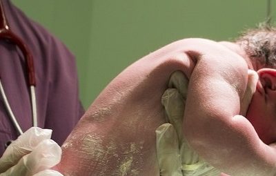 Nasce senza occhi e naso, ma il ginecologo non se ne accorge