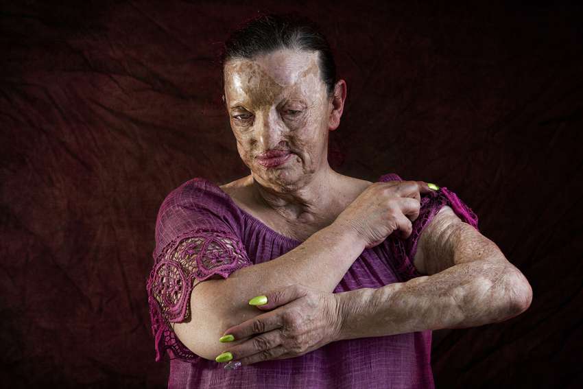 mostra violenza donne, mann