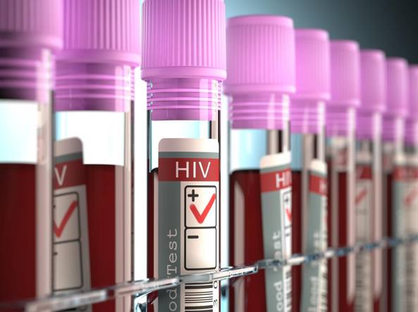 Infezioni sessualmente trasmissibili