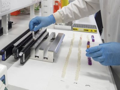 Torino, scoperto nuovo farmaco inibitore dei tumori ai polmoni, al colon e al pancreas