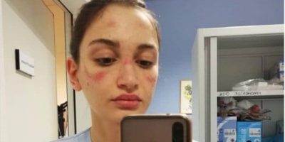 Gli infermieri lanciano un’appello: ̶...