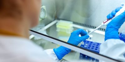 Covid, sono più a rischio i soggetti con gruppo...