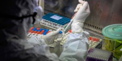 Usa, non si ferma la corsa del covid-19 aumenta...