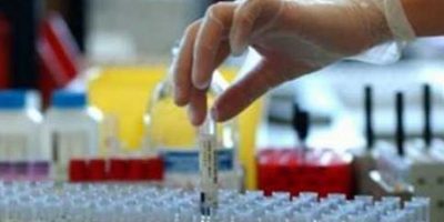 Allarme focolai virus di Covid-19 in alcuni mac...