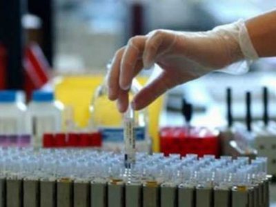 Allarme focolai virus di Covid-19 in alcuni macelli