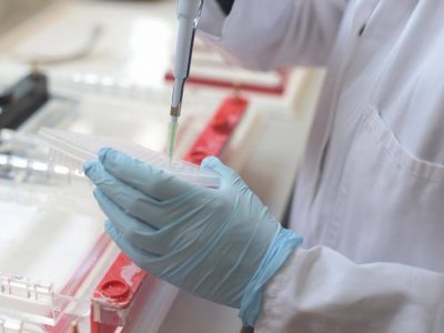 Leucemia linfoblastica acuta: una speranza di guarigione grazie alle cellule CARCIK