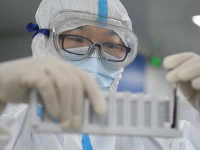 L’Oms in Cina per capire e non per incolpare Pechino di omissione di controlli