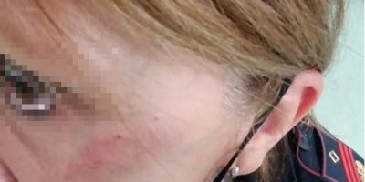 Vercelli, poliziotta presa a calci in faccia du...