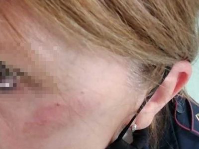 Vercelli, poliziotta presa a calci in faccia durante un controllo anti Covid