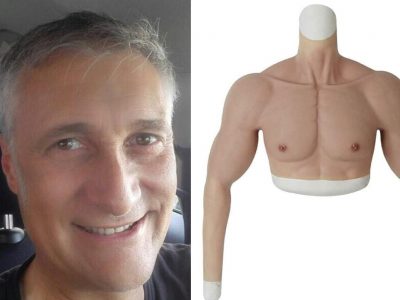 “Il braccio in silicone era una provocazione, lo rifarei” parla in tv l’odontoi...