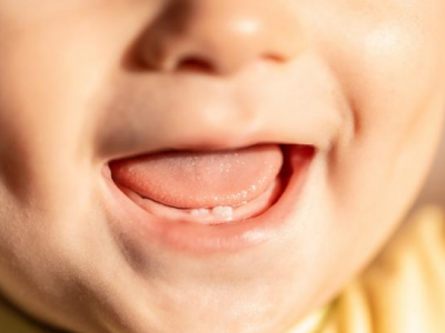 La dentizione dei bambini, cosa c’è da sapere